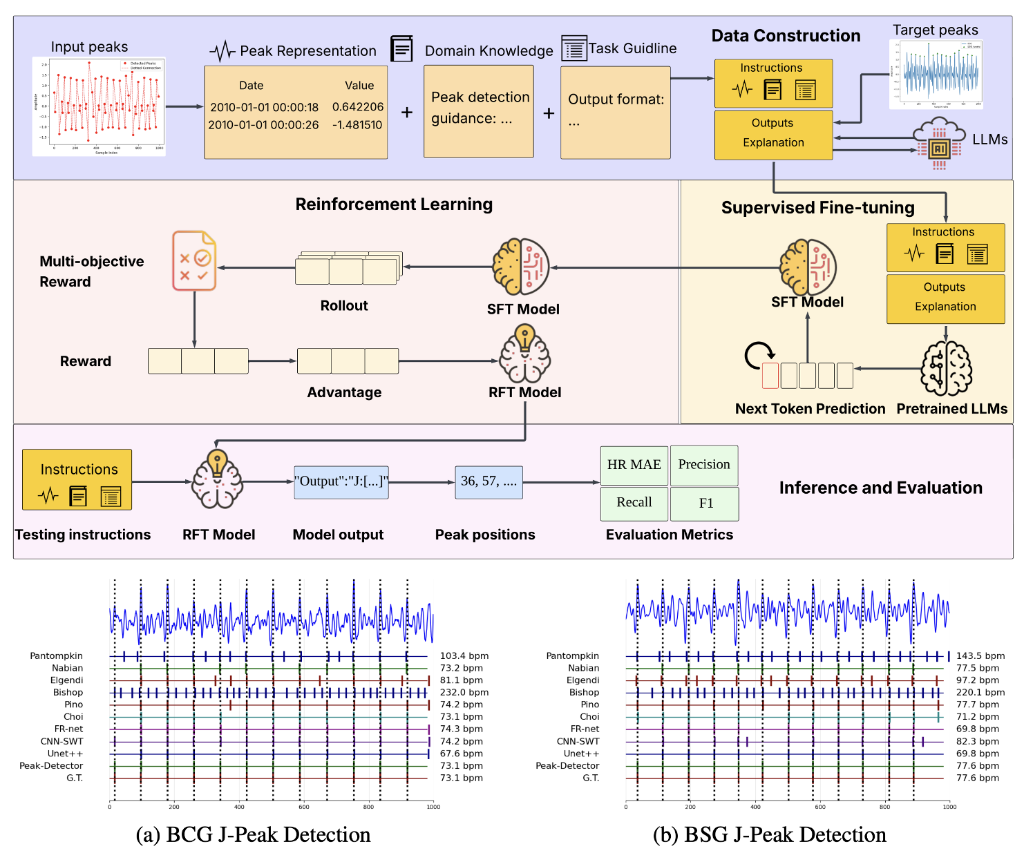 Peak-R1: Instruction-Tuned Large Language Models for Robust J-Peak Detection in Cardiomechanical Signals