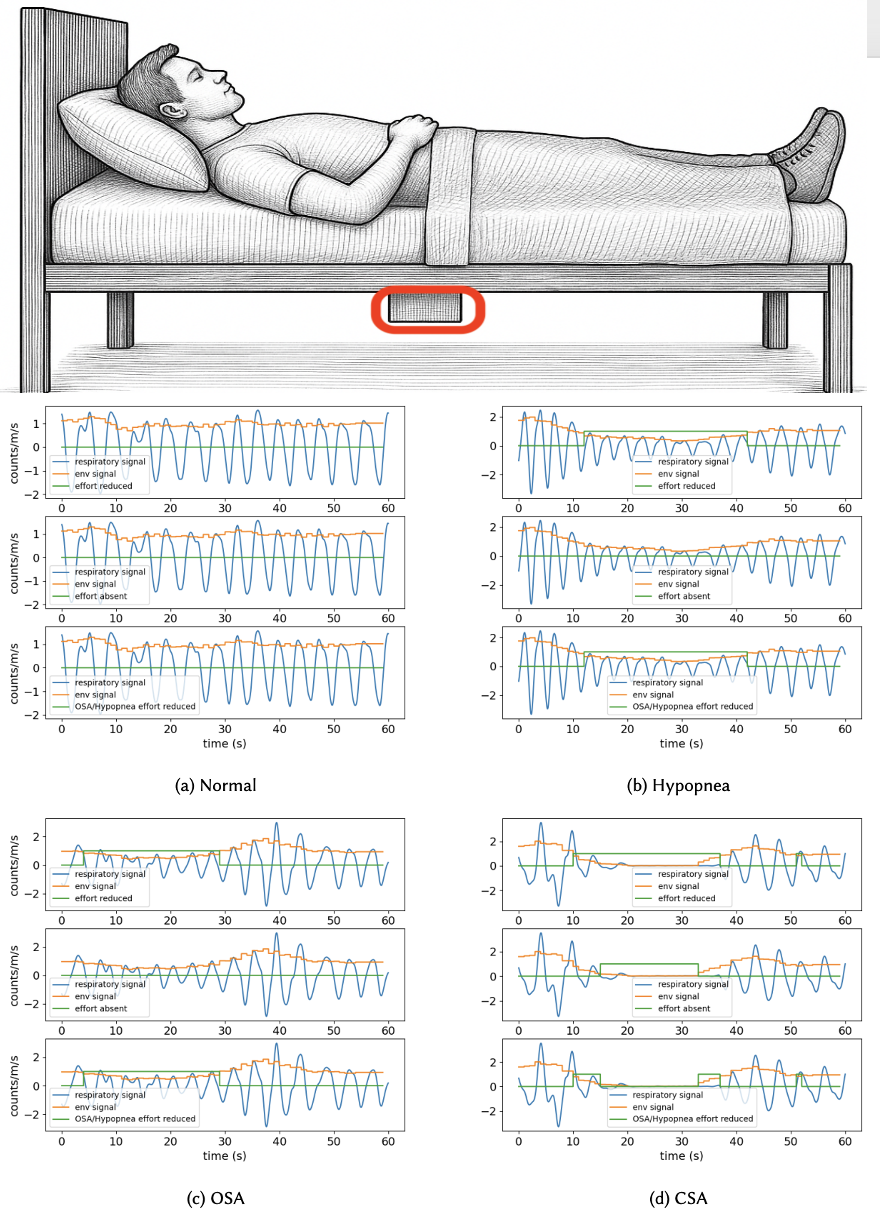 Contactless Sleep Apnea Detection with Bodyseismography