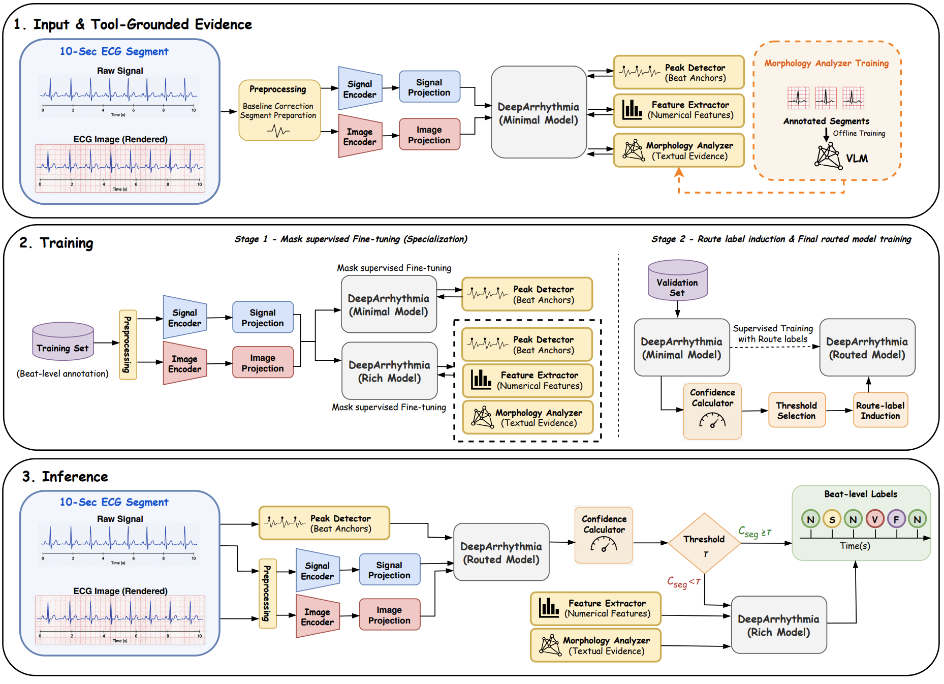 DeepArrhythmia: Segment-Contextualized ECG Arrhythmia Classification via Selective Evidence Acquisition