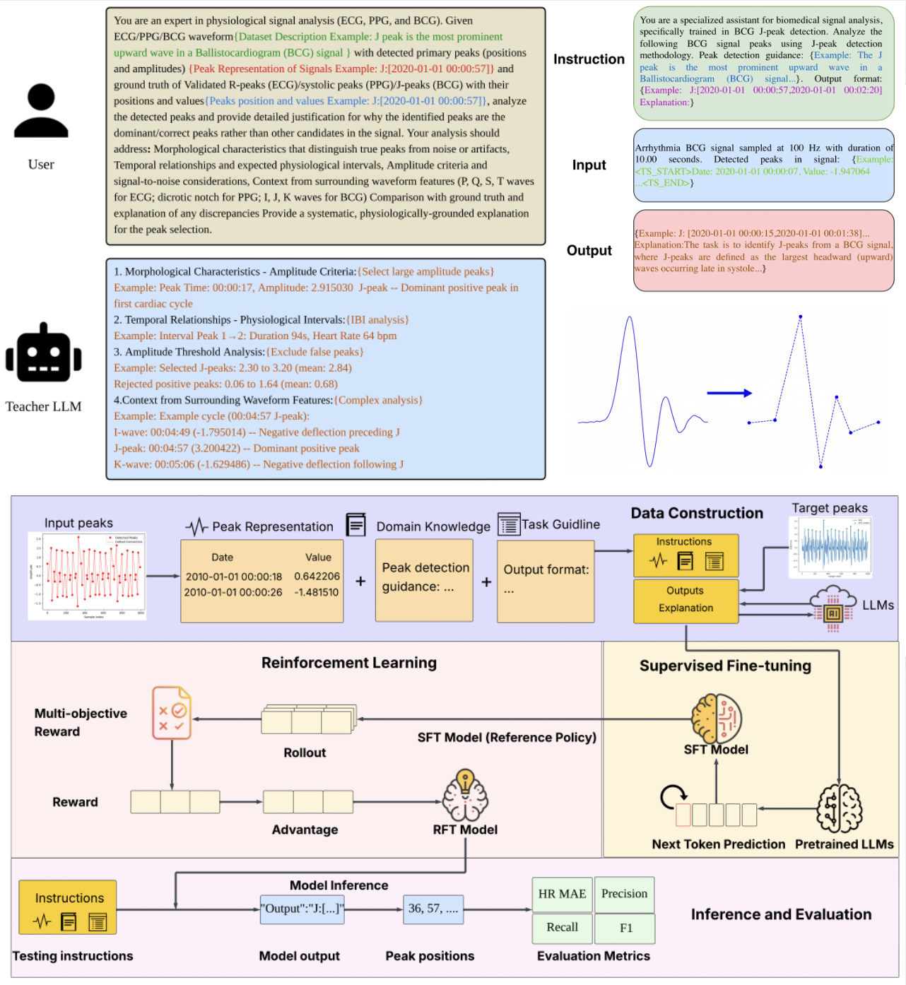 Peak-Detector: Explainable Peak Detection via Instruction–Tuned Large Language Models in Cardiac Physiological Signal